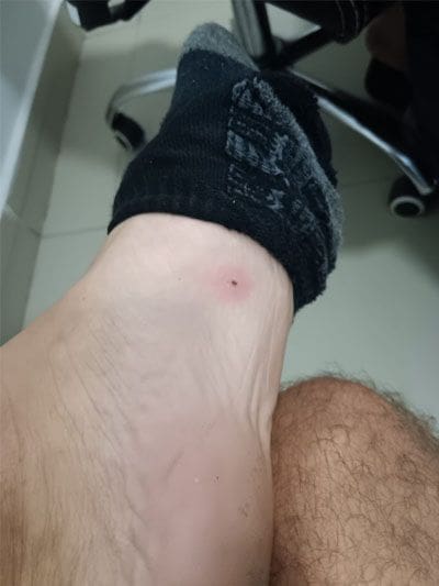 seguro de viaje a sri lanka roca dentro de pie en hospital